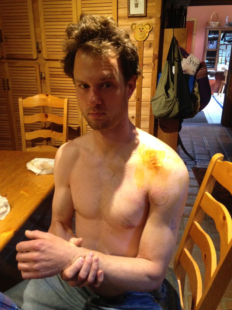 Jared on the mend 5-11-15